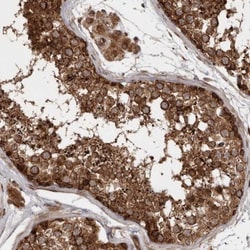 STK36 Antibody, Novus Biologicals 0.1mL; Unlabeled:Antibodies, Polyclonal